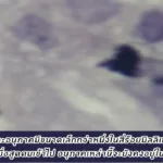 ALTV