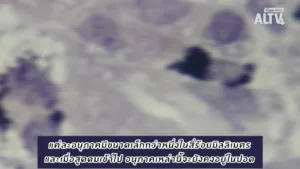 ALTV