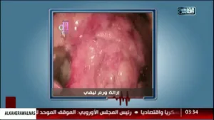 AlKahera WalNas 2
